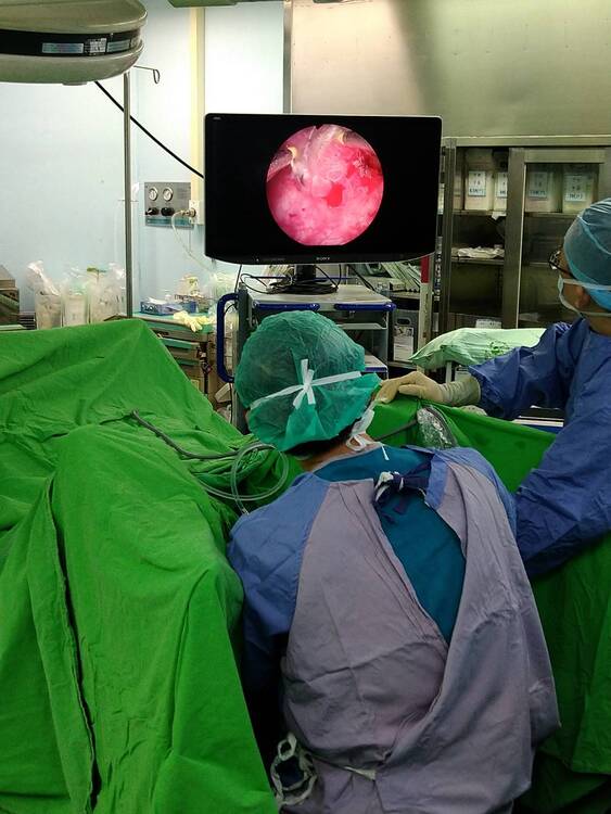 
	經尿道內視鏡腫瘤刮除手術
